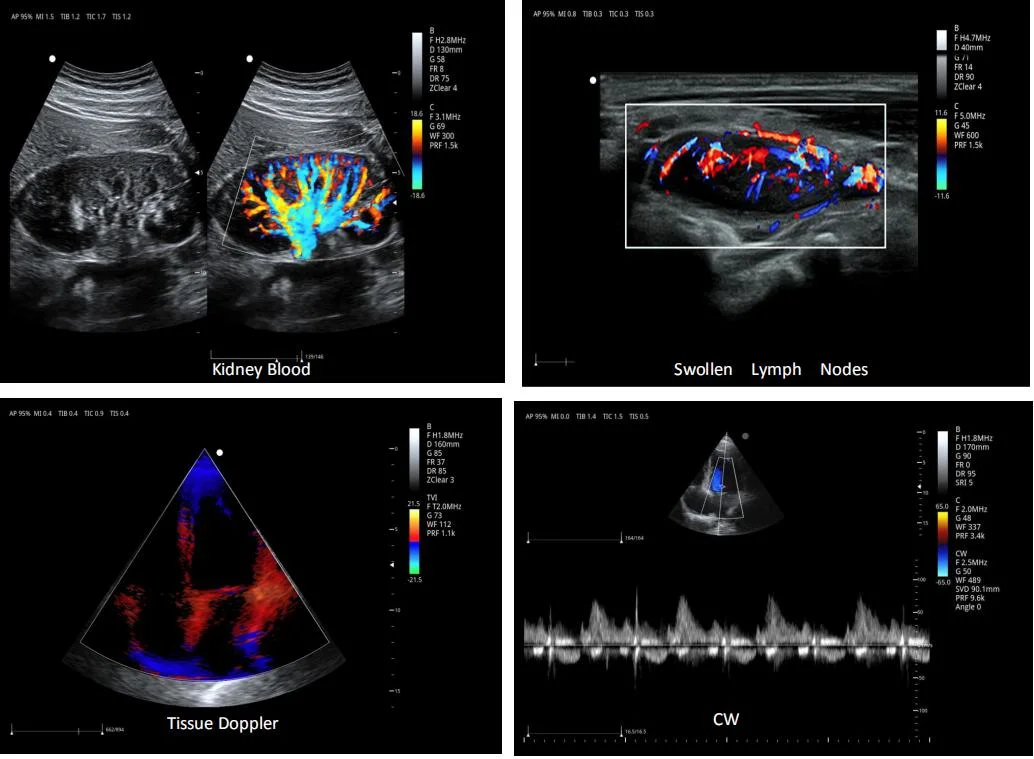 Trolley 3D/4D Color Ultrasound Machine in Abdomen, Ob/Gyn