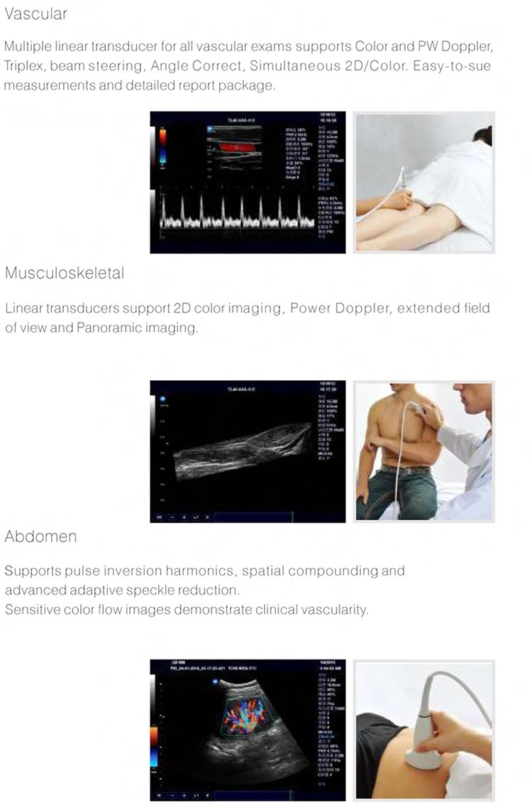 My-A030d Full Digital Color Doppler Ultrasound System