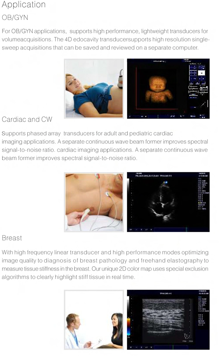 My-A030d Full Digital Color Doppler Ultrasound System