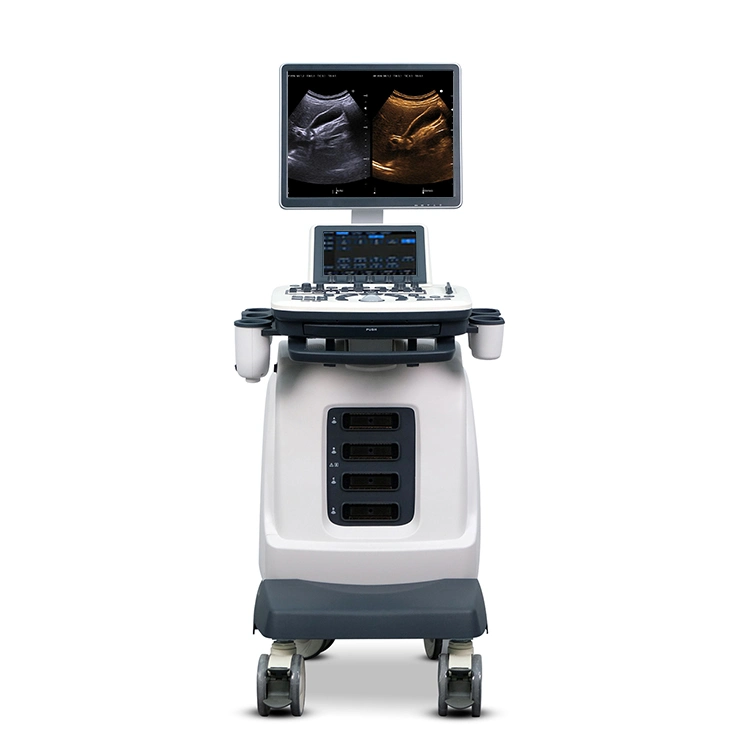 Ysb-S7 Hospital Medical Trolley Color Doppler 4D Ultrasound