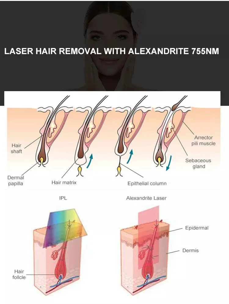 2023 Alex Laser 755nm 1064nm Alexandrite YAG Nitrogen Skin Cooling Fiber Conducted Laser Permanent Hair Removal Alexandrite Laser