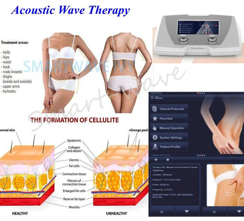Beauty Acoustic Wave Therapy for Cellulite 4th Gen Magnetic Electric Source Machine