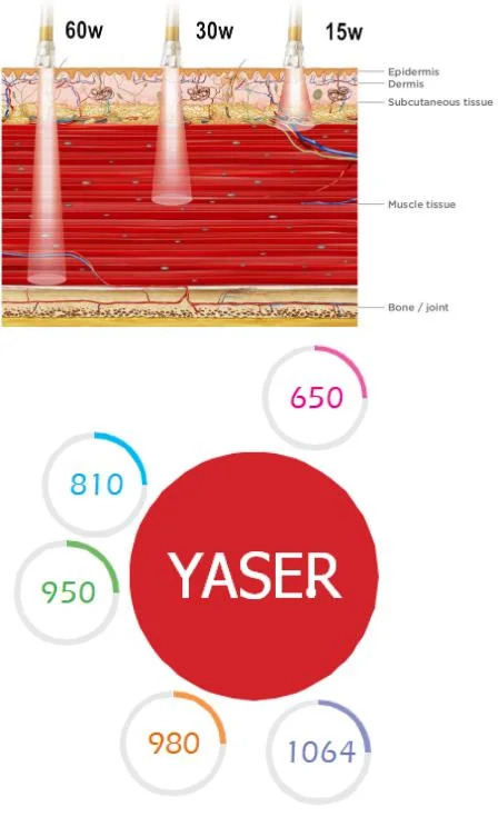 Laser Physiotherapy Class 4 Low Level Laser Hilt 980nm Therapy Laser Devices