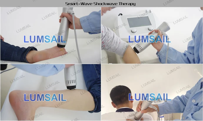 Extracorporeal Shock Wave Therapy Equipment Acoustic Shock Wave Therapy Machine