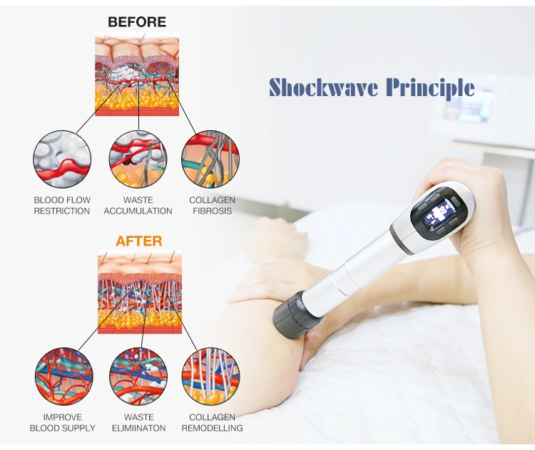 Relieve Shock Wave Machine Production Shock Wave Portable Reduce Pain