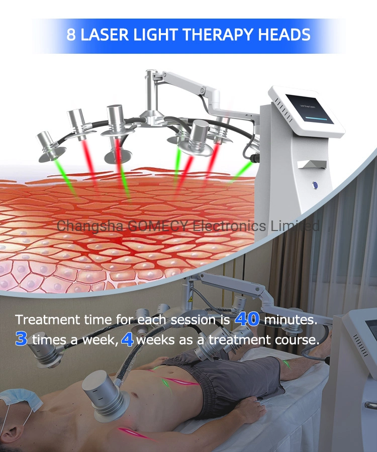 8d Lipo Laser 532nm Cold Light Therapy Body Slimming Weight Loss
