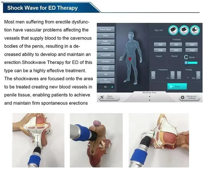 Portable Erectile Dysfunction Shockwave Therapy Equipment Pain Relief Focused Shock Wave Therapy Machine