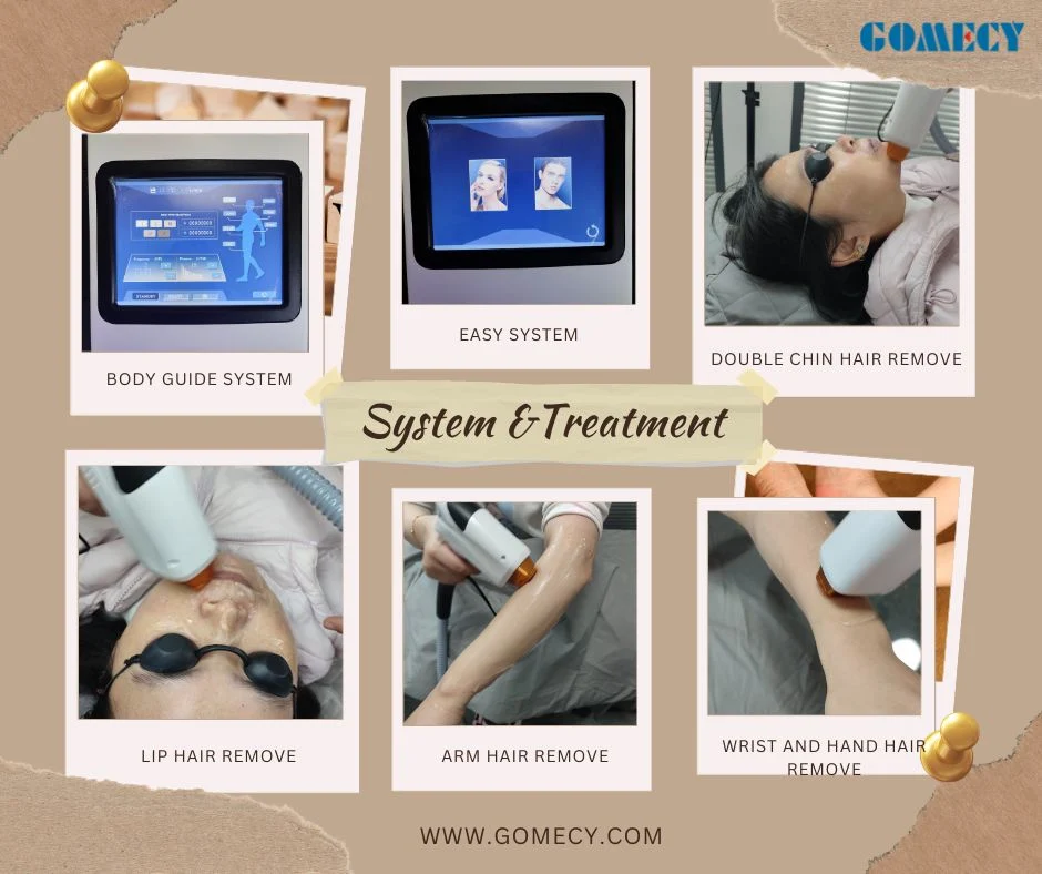 2024 Factory Price 3 Wave Diode Laser Hair Removal Machine Gomecy Factory SPA Clinic Treatment