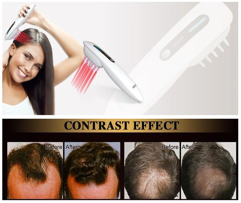 Low Level Laser Comb Treatment Hair Loss Laser Hair Growth Comb Red Light Therapy