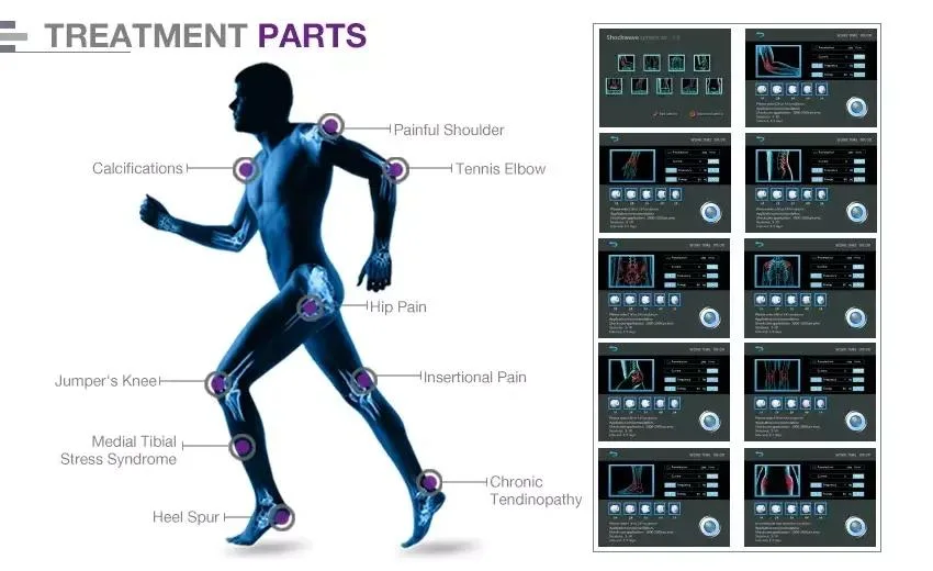 Low Intensity Extracorporeal Shockwave ED Erectile Dysfunction Therapy Machine Penis Enlargement