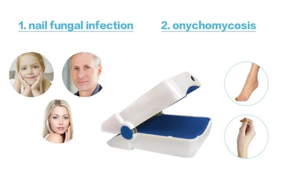 Fungal Infection Toenail Laser Treatment Machine Laser Therapeutic Device Blue Light Therapy Equipment