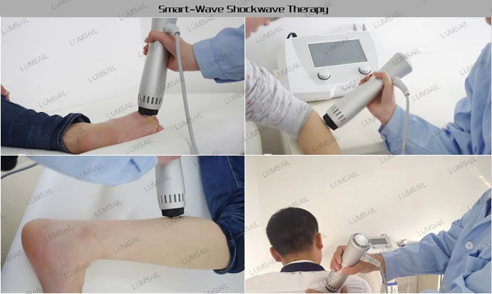 Radial Shockwave Therapy Machine for Face Tmj Pain