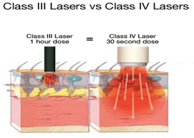 Laseev Yaser Diode Laser 1064nm 980nm 810nm Treatment Veterinary Therapy Laser Equipments for Vet Pets