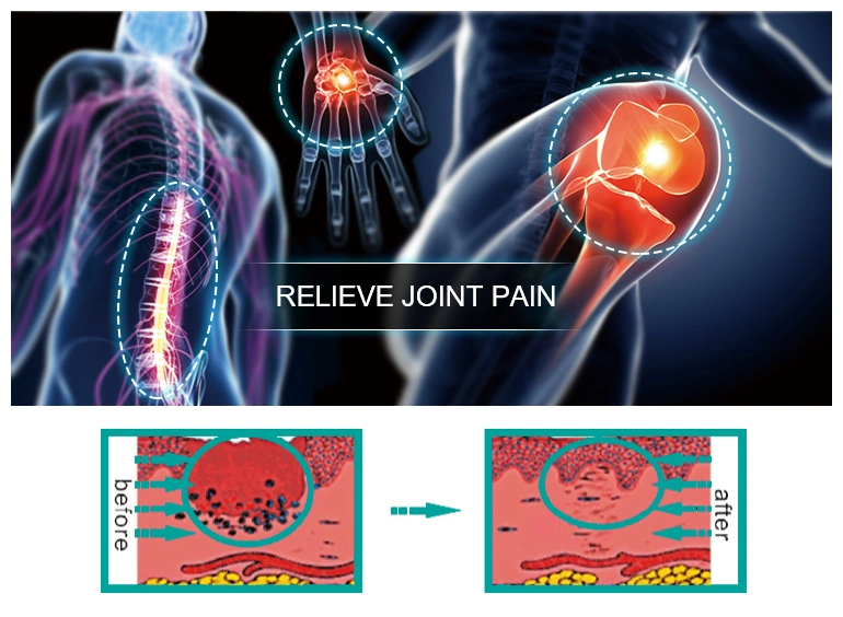 Portable Handheld Low Level Cold Soft 808nm 650nm Laser Therapy Device for Muscle Joint Pain