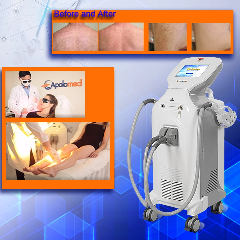 New Laser Hair Removal with Good Production Line