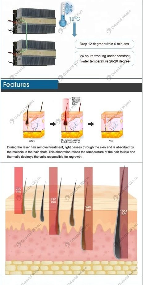 Diode Laser 2 Handle 4 Wavelength Diode Laser 755nm 808nm 940nm 1064nm Laser Hair Removal Lasers for SPA Salon