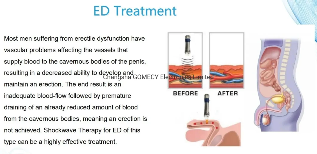Shockwave+Vacuum 2 in 1 ED Treatment Physiotherapy Machine