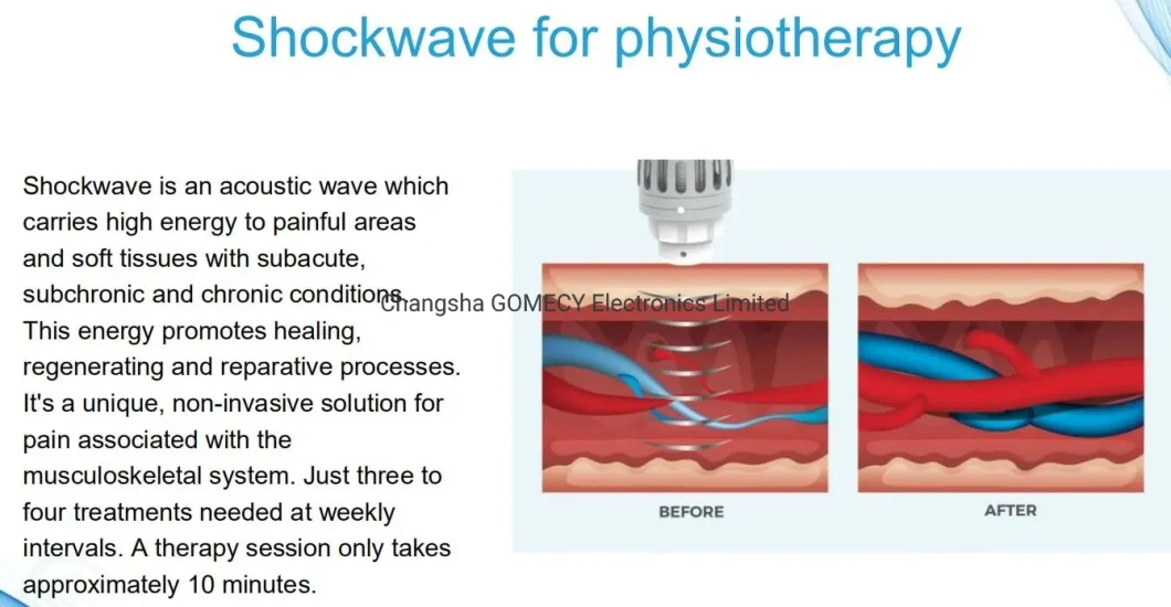 Shockwave+Vacuum 2 in 1 ED Treatment Physiotherapy Machine