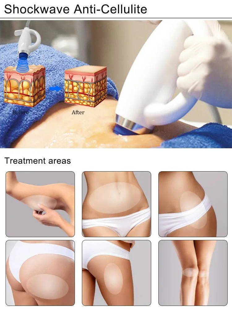 New Design Shockwave Non-Invasion Anti-Cellulite Muscle Relaxing Body Therapy Massage Equipment