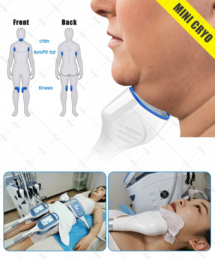 Ofan Criolipolisis Y Ultrasonido Criolipolisis 360 Multifuncional Liposuction Machine Slimming Machines for Cryolipolysis