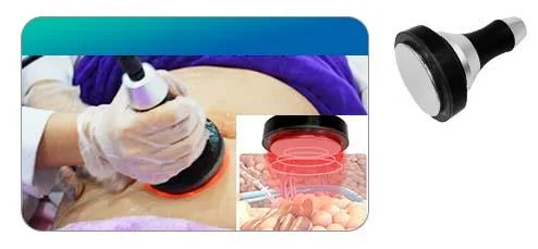 Best Seller Portable 360 Degree Different Sizes Fat Freezing Skin Tightening Blood Circulation Improving Body Slimming Multifunctional Beauty Equipment