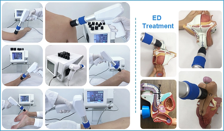 Eswt Shockwave Therapy Machine for ED Erectile Dysfunction Physiotherapy Equipment