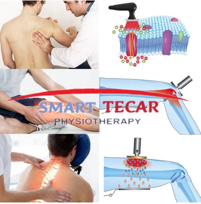 3 in 1 Smart Tecar Wave RF EMS ED Shockwave Therapy Tecar Physiotherapy Machines for Pain Relief