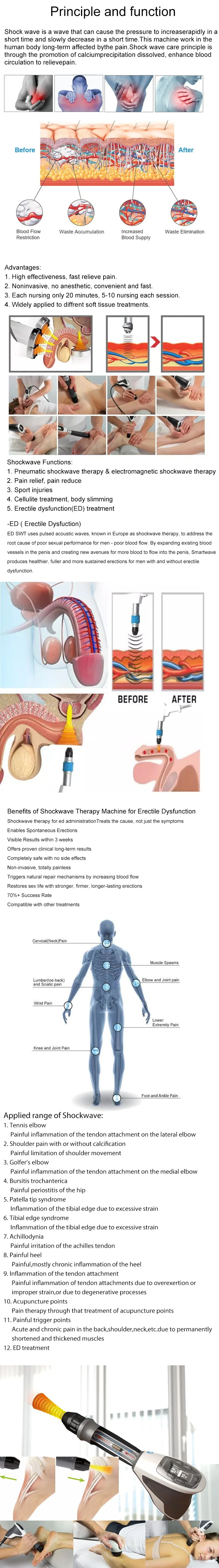 Neck Pain Relife Storz Focal Shockwave Therapy Machine ED Focused Shock Wave Equipment