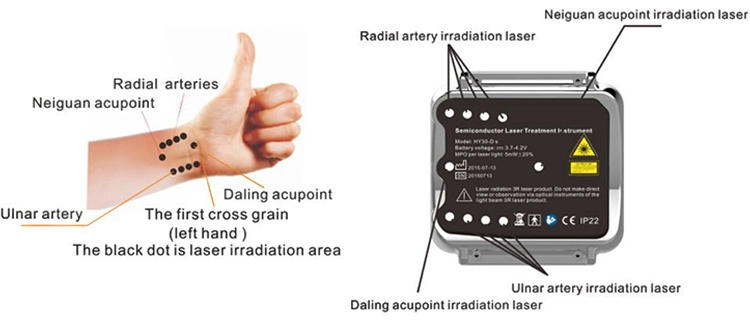 Wrist Seco Laser Treatment Instrument (HY-25C)