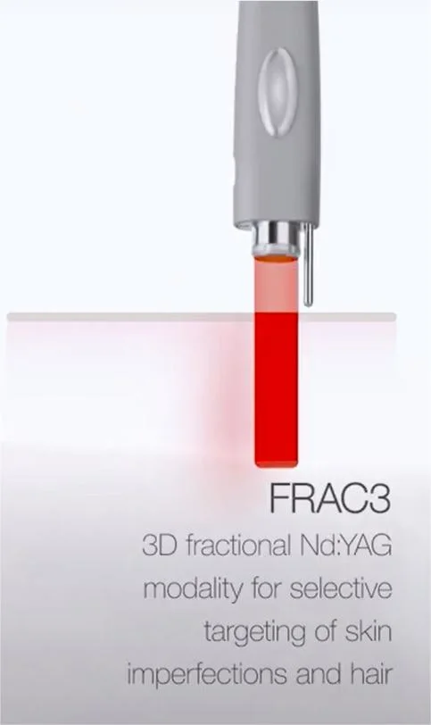 No Pain Best Fractional CO2 Laser 4in1 Fraccionado Ladies Vagina Tightening Device