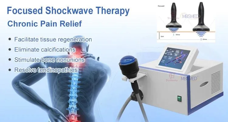 Extracorporeal Focused Physiotherapy and Rehabilitation Pain Relief New Soft Wave Therapy Machine