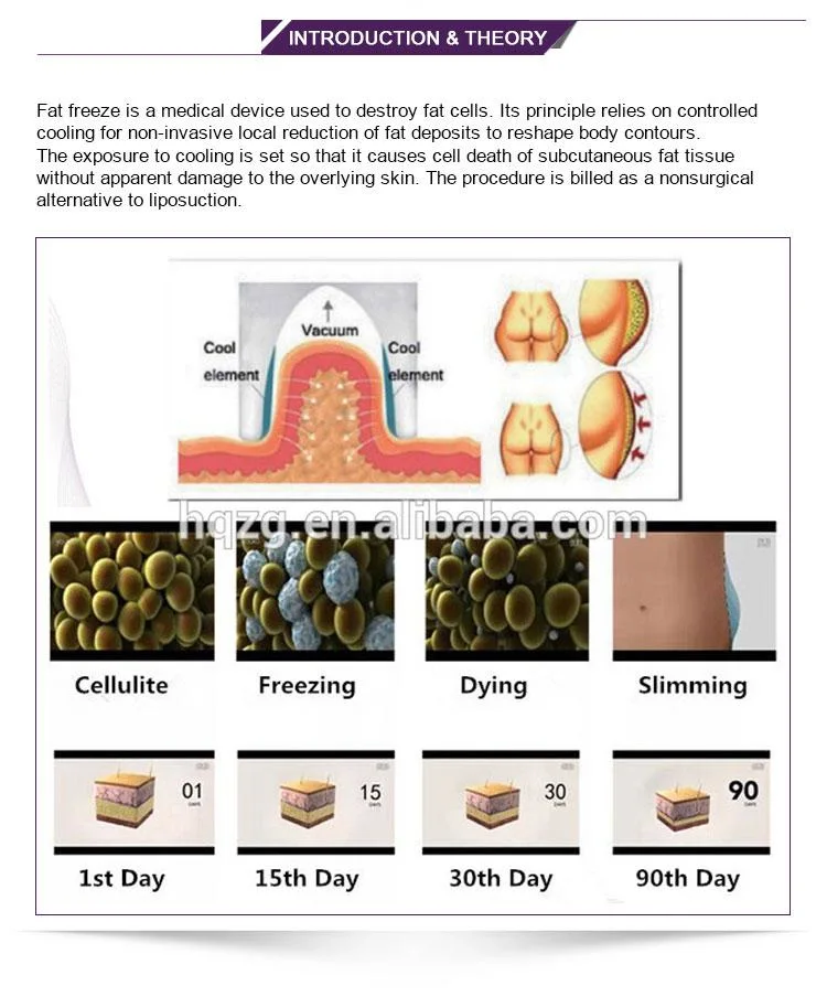 Professional Fat Freezing Device Cryotherapy Treatment