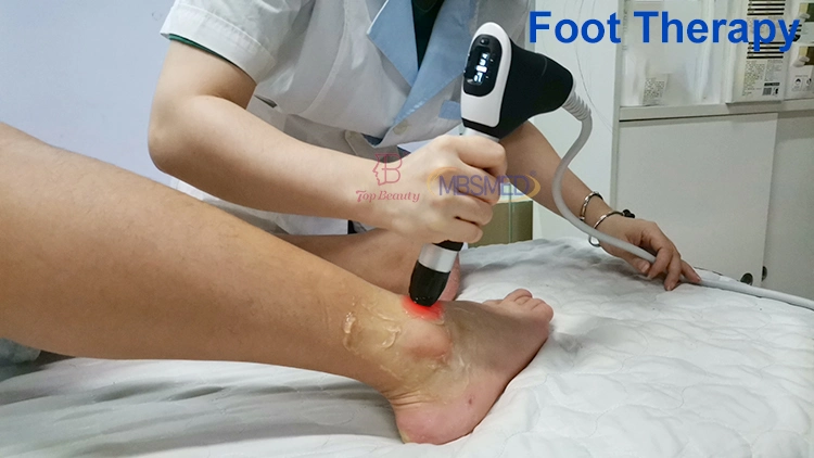 Best Price Extracorporeal Shockwave Therapy Plantar Fasciitis Terapia Ondas De Choque Shock Wave Machine