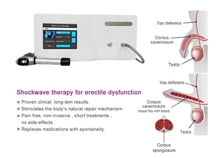 Portable Equipo De Fisioterapia Shockwave Therapy Machine Europe for Erectile Dysfunction