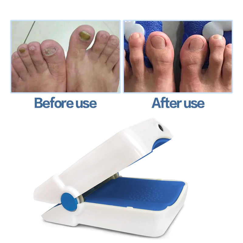 Lllt Cold Laser Nail Fungus Treatment Laser Therapy Device Nails Cleaning Physiotherapy Device