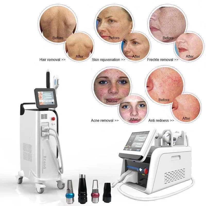 Professional Opt Dpl IPL 2 in 1 Acne Treatment Dpl Hair Removal