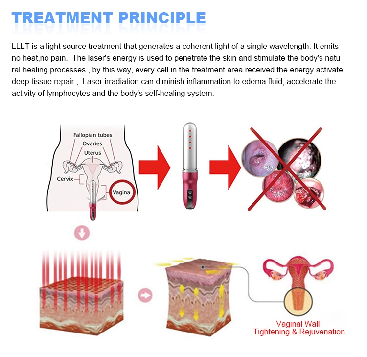 Red LED Light Cold Laser Therapy Device for Vaginal Infection Vaginitis Treatment Health Care