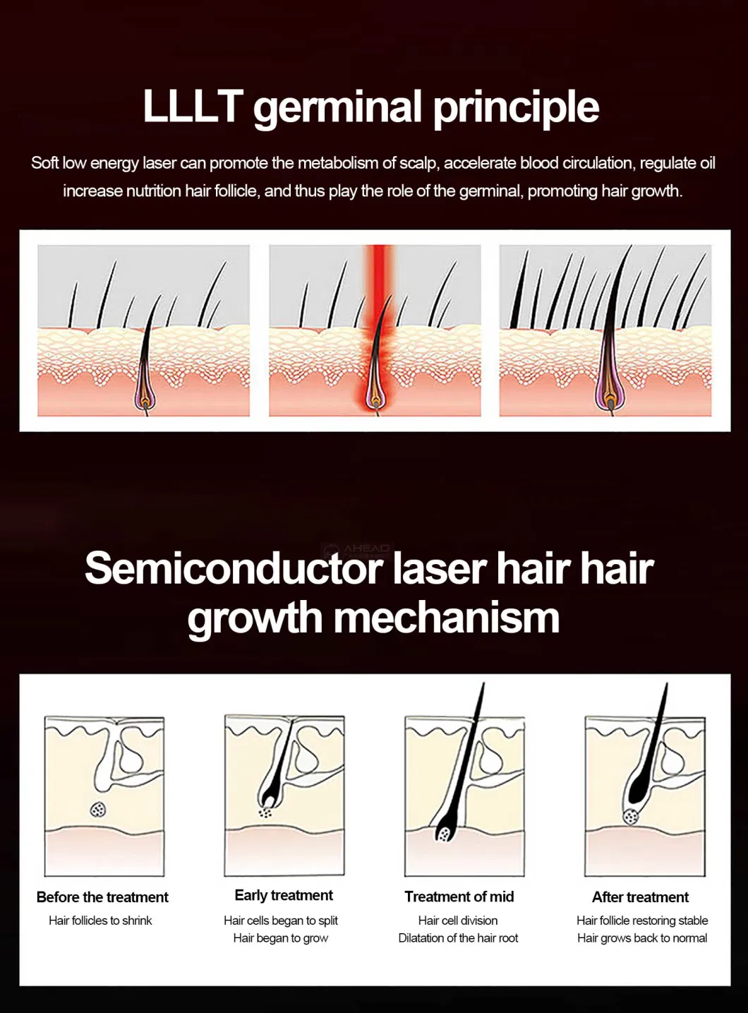 High Quality Infrared Low Level Laser Cap 108 Hair Regrowth Cap 650nm Hair Loss Treatment