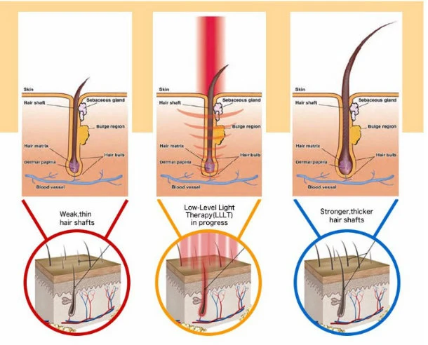 Low Level Laser Hair Growth Hair Loss Treatment Device