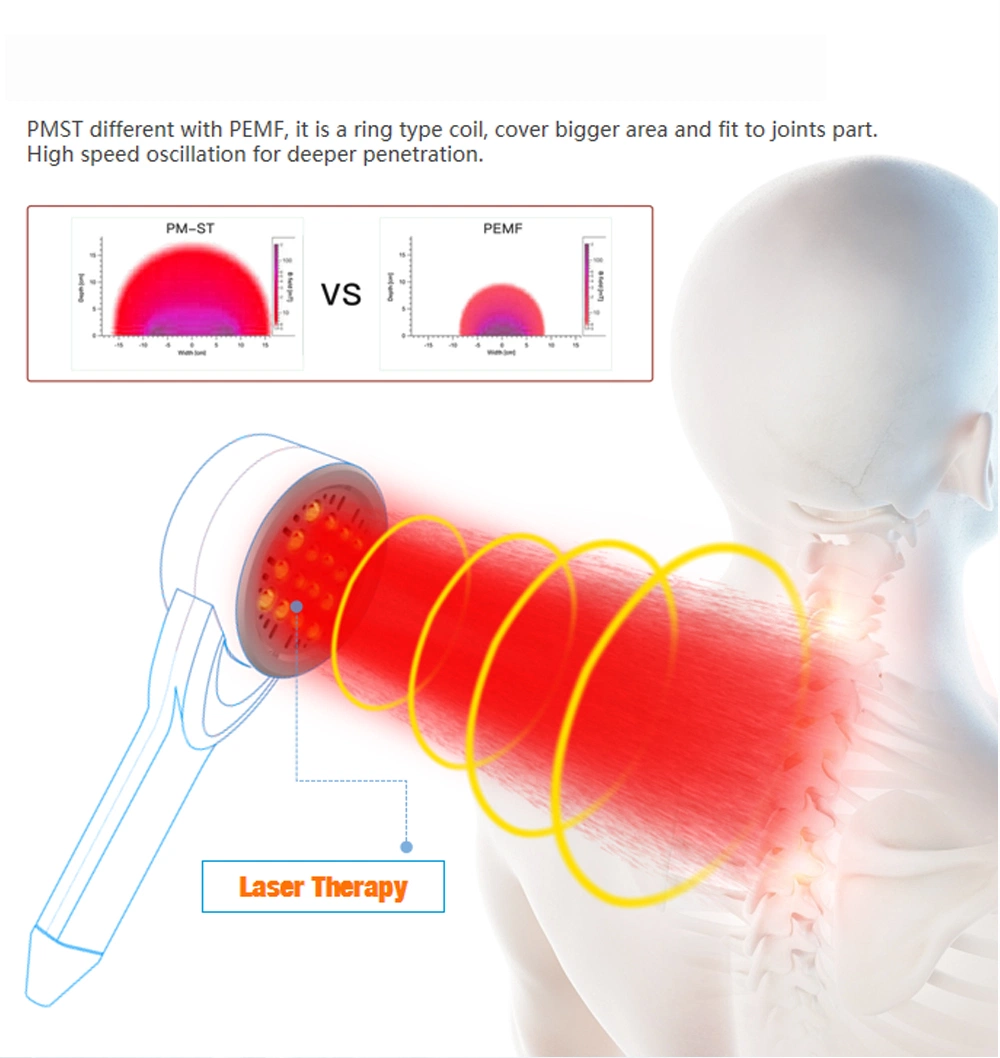 My-S621A Hot Sale Vertical Plus Laser Therapy for Pain Relief Laser Therapy Machine