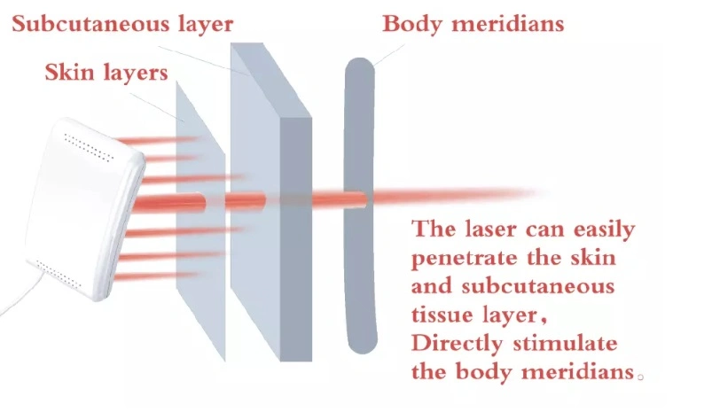 Lllt Medical Physical Multifunction Deep Tissue Cold Laser Therapy Physiotherapy Equipment for Pain