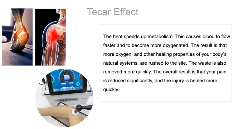New Arrivals Ultrasonic High Frequency Shockwave Tecar RF Machine for Pain Relief