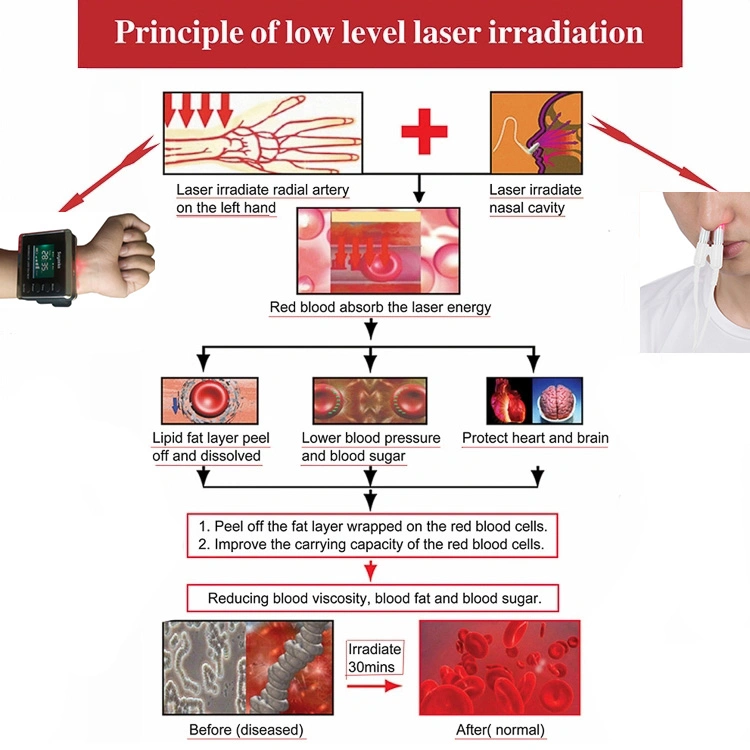 Medical Infrared Low Level Laser Therapy Hypertension Diabetic Treatment Device