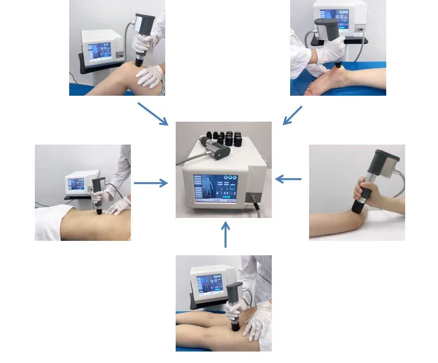 Gainswave Pneumatic Shockwave Machine Focused Shock Wave Therapy for ED Erectile Dysfunction Physiotherapy Equipment