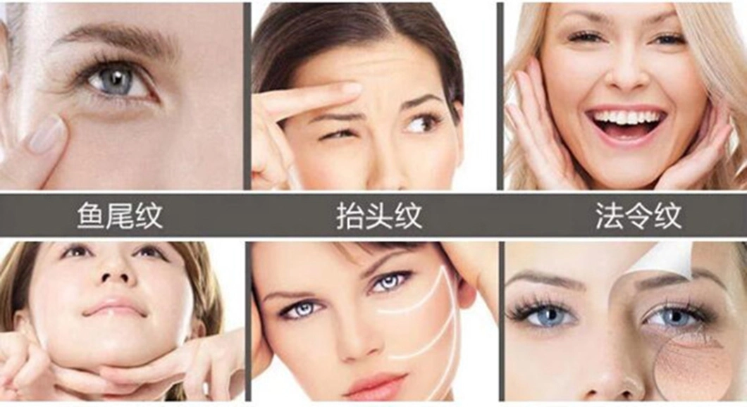 Home Use RF Face Lifting Tighteing Facial Skin Care Beauty Machine
