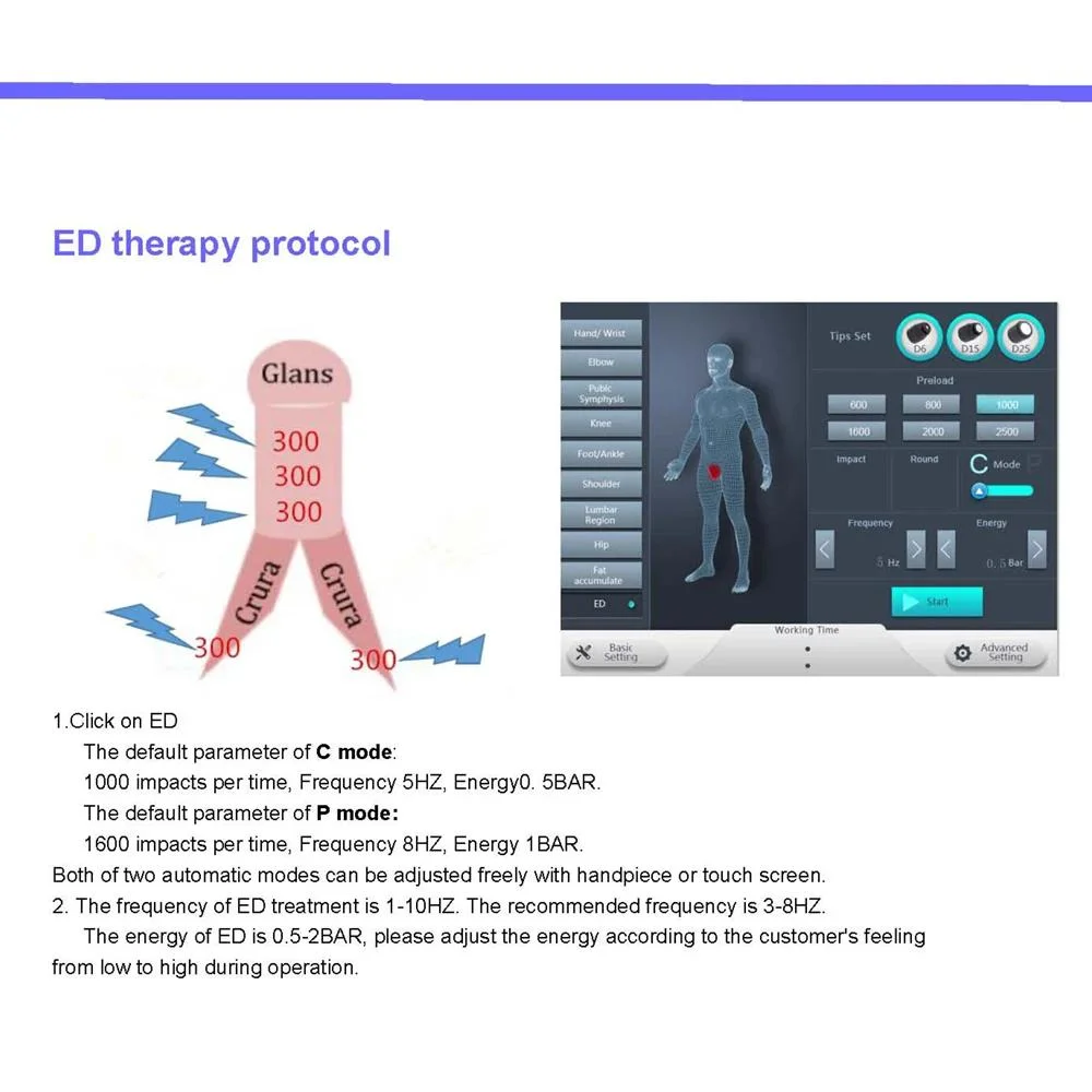 Portable Electric Shock Wave Physical Therapy Equipments Shockwave Therapy Machine for ED