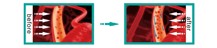 Handheld Cold Laser Therapy Device for Rehabilitation