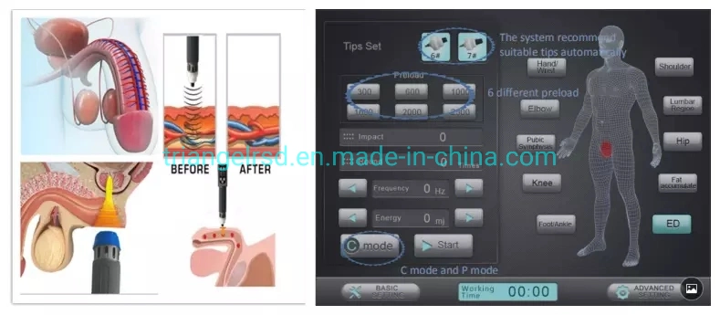High Effectiveness Shockwave Cellulite Therapy Machine Shock Wave Therapy Device