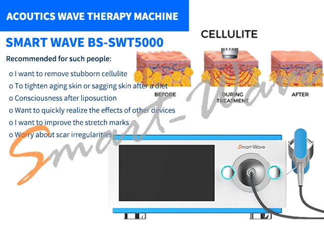 BS-Swt5000 Radial Pulse Wave Rpt Extracorporeal Shockwave Therapy Shock Wave Therapy Equipment