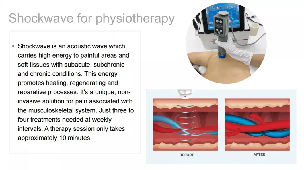 Physical Therapy Equipment Rehabilitation Equipment Physical Shock Wave Therapy Machine Price